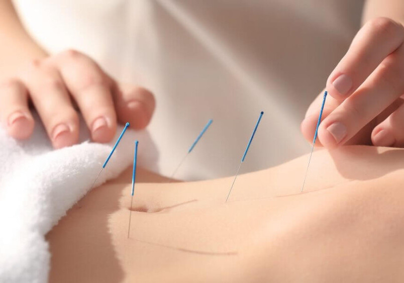 Complementary medicines for treatment of lower back pain